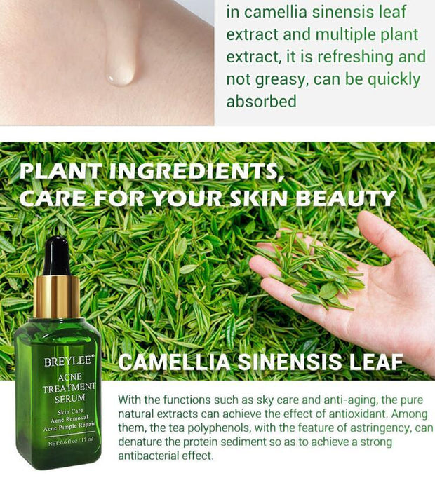 Acne Treatment Acne Treatment Serum Facial Repair Oil