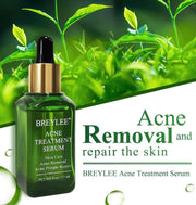 Acne Treatment Acne Treatment Serum Facial Repair Oil